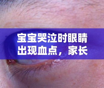 寶寶哭泣時(shí)眼睛出現(xiàn)血點(diǎn)，家長(zhǎng)需警惕的緊急信號(hào)與應(yīng)對(duì)措施