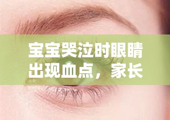 寶寶哭泣時(shí)眼睛出現(xiàn)血點(diǎn)，家長(zhǎng)需警惕的緊急信號(hào)與應(yīng)對(duì)措施