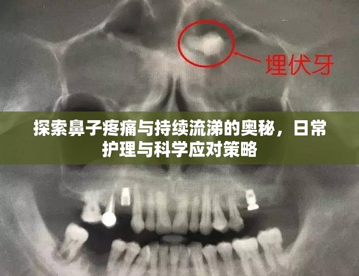 探索鼻子疼痛與持續(xù)流涕的奧秘，日常護理與科學應對策略