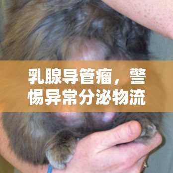 乳腺導(dǎo)管瘤，警惕異常分泌物流出的信號