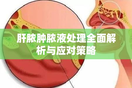 肝膿腫膿液處理全面解析與應(yīng)對(duì)策略