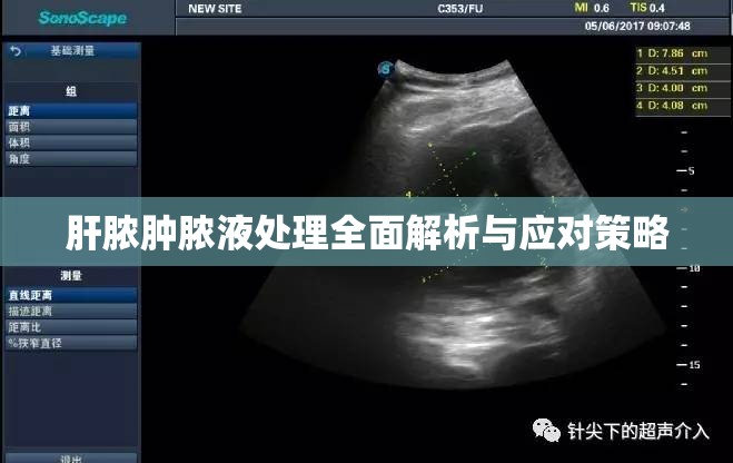 肝膿腫膿液處理全面解析與應(yīng)對(duì)策略
