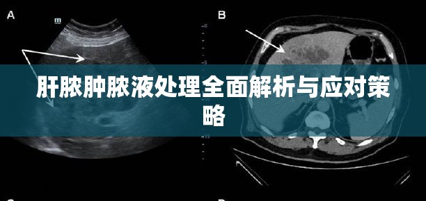 肝膿腫膿液處理全面解析與應(yīng)對(duì)策略