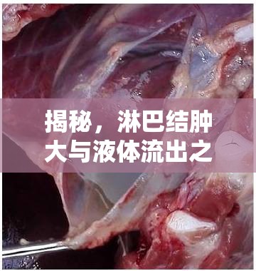 揭秘，淋巴結(jié)腫大與液體流出之間的真相