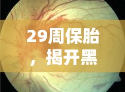 29周保胎，揭開黑色血塊之謎