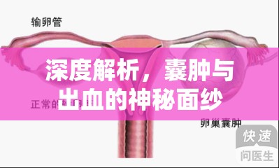 深度解析，囊腫與出血的神秘面紗