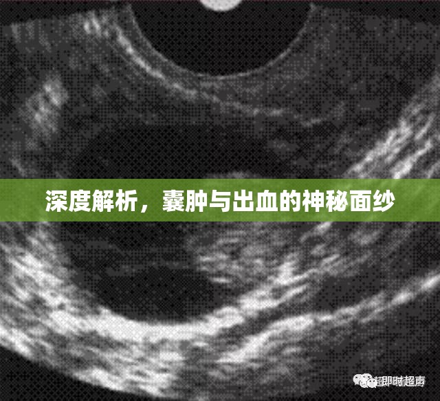 深度解析，囊腫與出血的神秘面紗