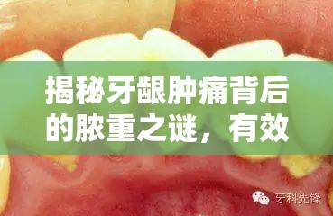 揭秘牙齦腫痛背后的膿重之謎，有效應(yīng)對(duì)與預(yù)防策略