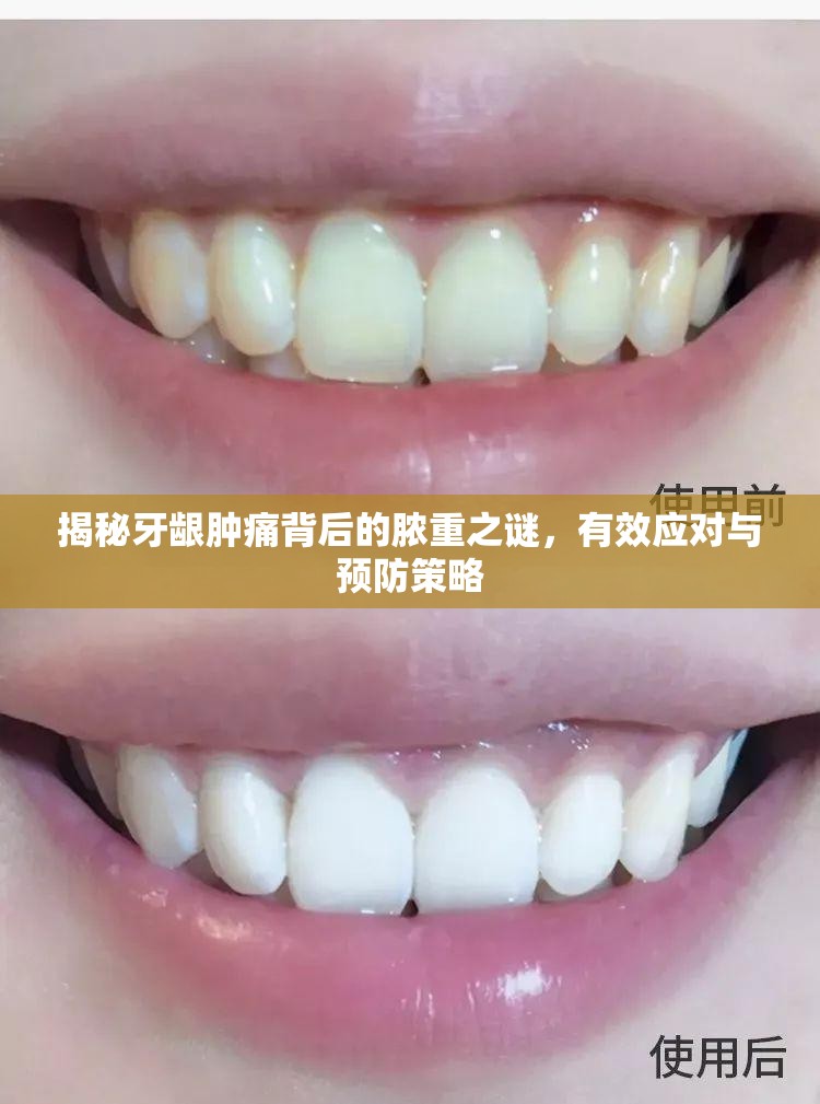 揭秘牙齦腫痛背后的膿重之謎，有效應(yīng)對(duì)與預(yù)防策略