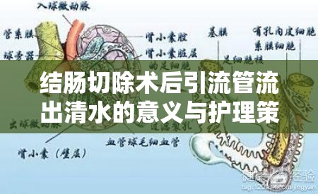 結(jié)腸切除術(shù)后引流管流出清水的意義與護理策略