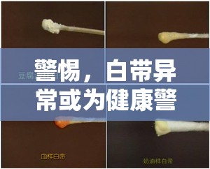 警惕，白帶異?；?yàn)榻】稻? title=
