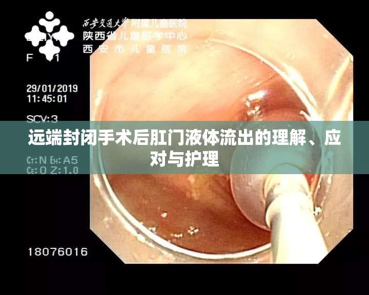 遠(yuǎn)端封閉手術(shù)后肛門液體流出的理解、應(yīng)對與護(hù)理