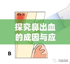 探究鼻出血的成因與應對策略