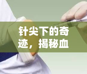針尖下的奇跡，揭秘血管打針后血液的靜默之謎
