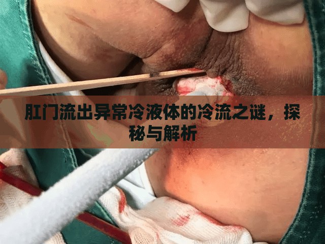肛門流出異常冷液體的冷流之謎，探秘與解析