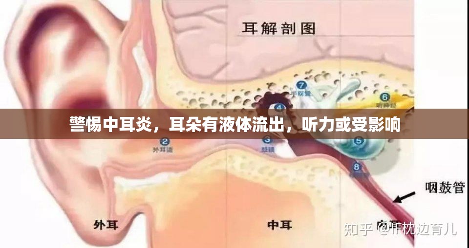 警惕中耳炎，耳朵有液體流出，聽力或受影響