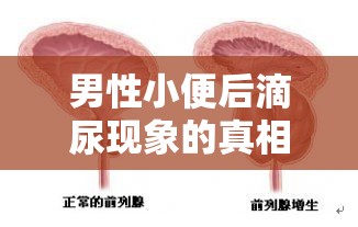 男性小便后滴尿現(xiàn)象的真相