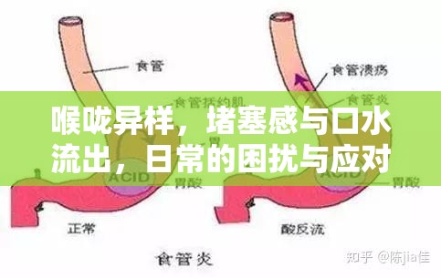 喉嚨異樣，堵塞感與口水流出，日常的困擾與應(yīng)對策略