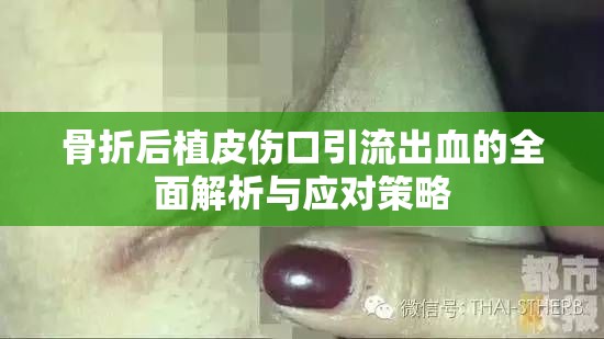 骨折后植皮傷口引流出血的全面解析與應對策略