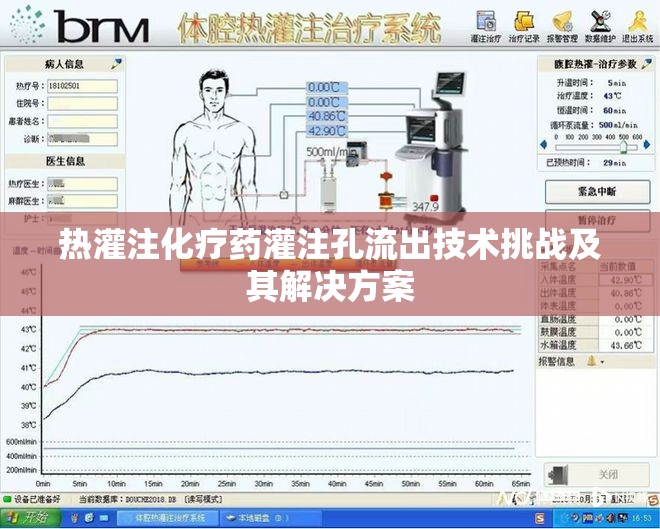 熱灌注化療藥灌注孔流出技術(shù)挑戰(zhàn)及其解決方案