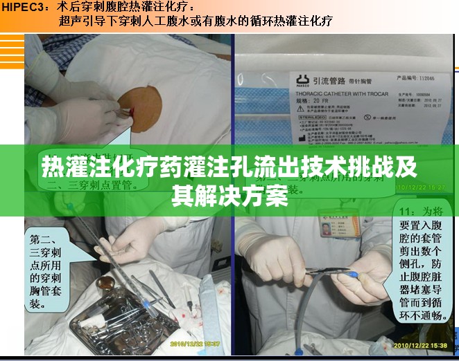 熱灌注化療藥灌注孔流出技術(shù)挑戰(zhàn)及其解決方案