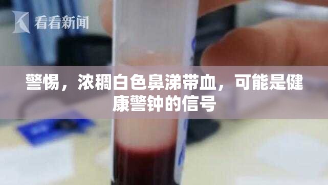 警惕，濃稠白色鼻涕帶血，可能是健康警鐘的信號
