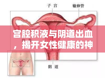 宮腔積液與陰道出血，揭開女性健康的神秘面紗
