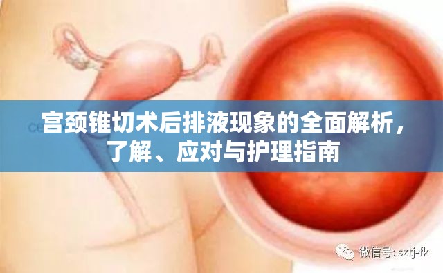 宮頸錐切術(shù)后排液現(xiàn)象的全面解析，了解、應(yīng)對(duì)與護(hù)理指南