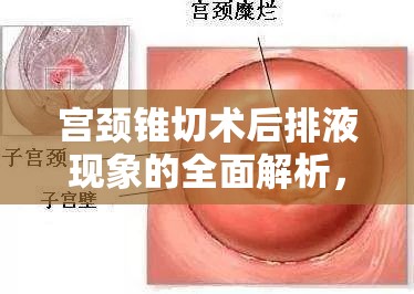 宮頸錐切術(shù)后排液現(xiàn)象的全面解析，了解、應(yīng)對(duì)與護(hù)理指南