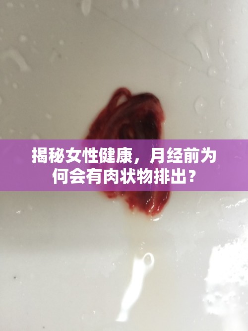 揭秘女性健康，月經(jīng)前為何會(huì)有肉狀物排出？
