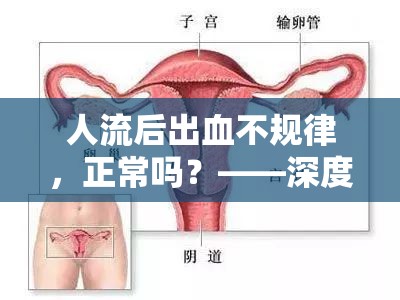 人流后出血不規(guī)律，正常嗎？——深度解析與應(yīng)對(duì)策略