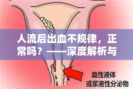 人流后出血不規(guī)律，正常嗎？——深度解析與應(yīng)對(duì)策略