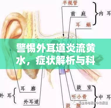 警惕外耳道炎流黃水，癥狀解析與科學(xué)應(yīng)對策略