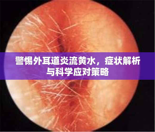 警惕外耳道炎流黃水，癥狀解析與科學(xué)應(yīng)對策略