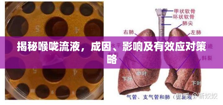 揭秘喉嚨流液，成因、影響及有效應(yīng)對(duì)策略