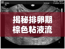 揭秘排卵期棕色粘液流出的真相