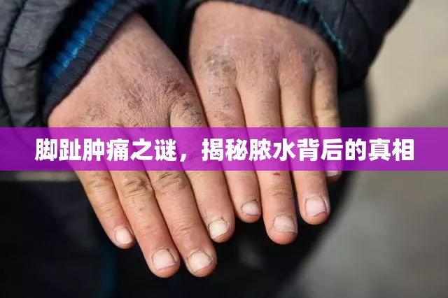 腳趾腫痛之謎，揭秘膿水背后的真相