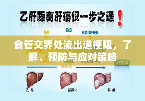 食管交界處流出道梗阻，了解、預(yù)防與應(yīng)對策略