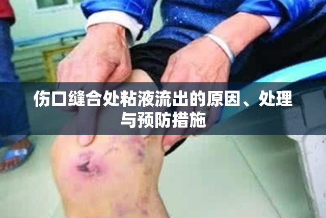 傷口縫合處粘液流出的原因、處理與預(yù)防措施