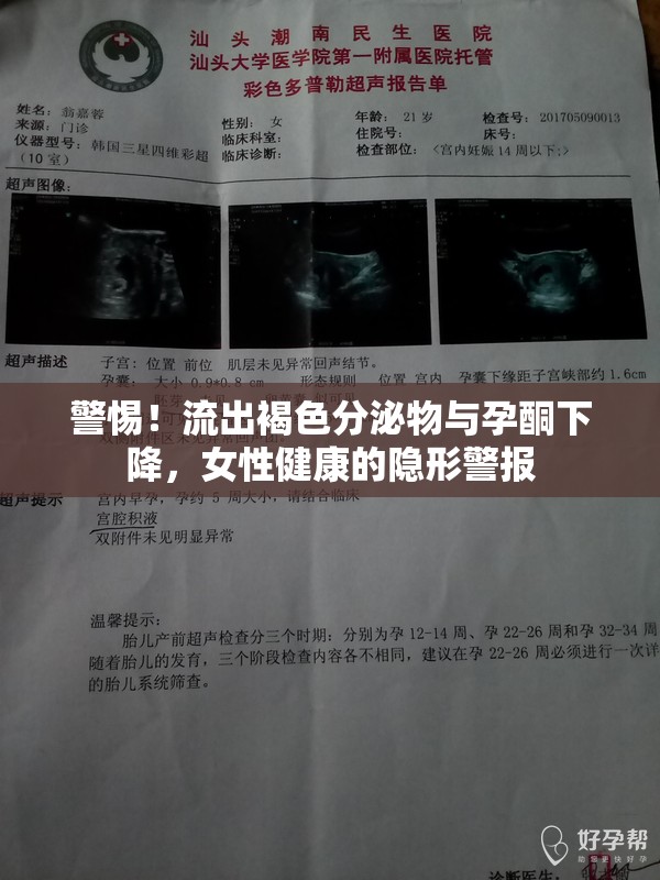 警惕！流出褐色分泌物與孕酮下降，女性健康的隱形警報(bào)