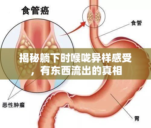 揭秘躺下時喉嚨異樣感受，有東西流出的真相
