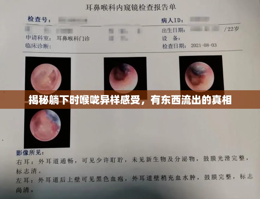 揭秘躺下時喉嚨異樣感受，有東西流出的真相