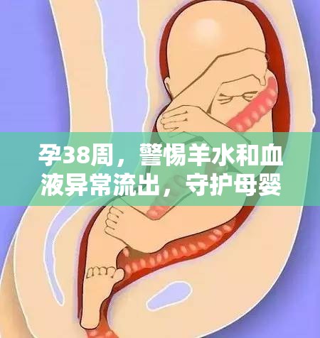 孕38周，警惕羊水和血液異常流出，守護母嬰安全的警鐘