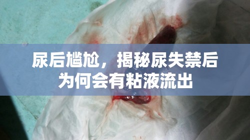 尿后尷尬，揭秘尿失禁后為何會有粘液流出