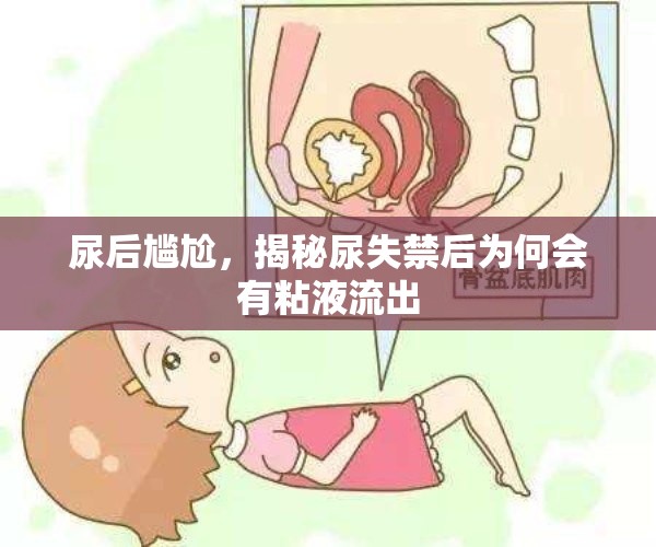尿后尷尬，揭秘尿失禁后為何會有粘液流出