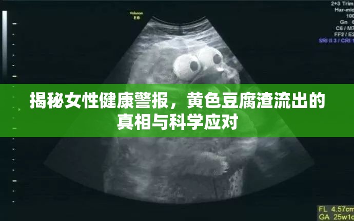 揭秘女性健康警報，黃色豆腐渣流出的真相與科學(xué)應(yīng)對