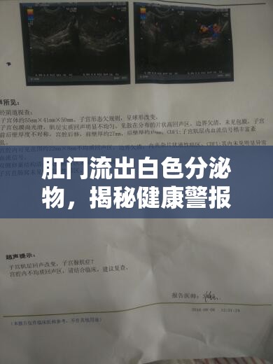 肛門流出白色分泌物，揭秘健康警報的真相
