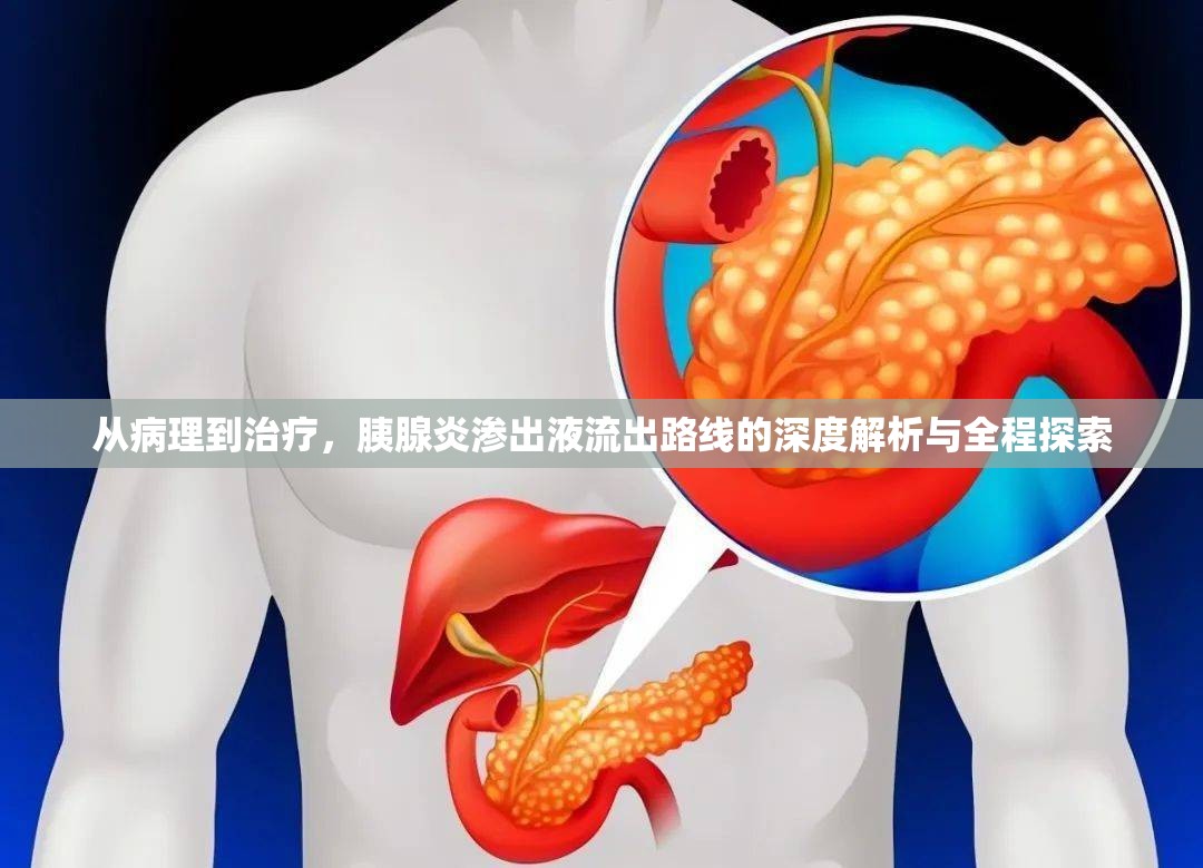 從病理到治療，胰腺炎滲出液流出路線的深度解析與全程探索