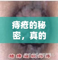 痔瘡的秘密，真的會有異物流出嗎？