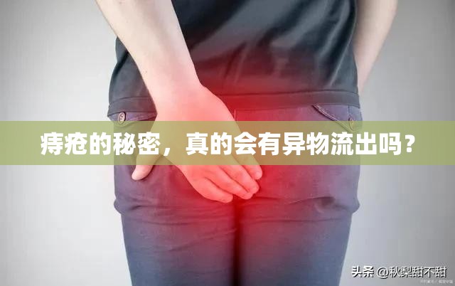 痔瘡的秘密，真的會有異物流出嗎？